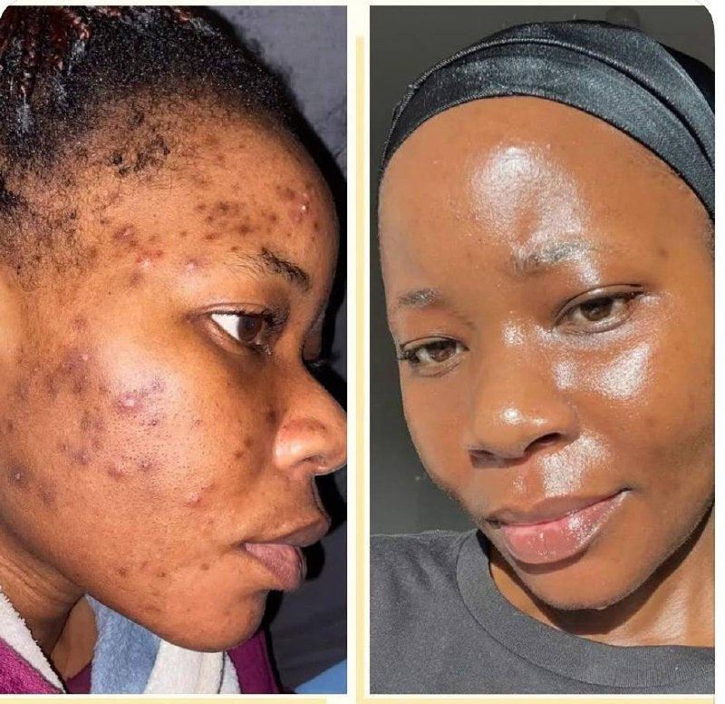 Duo Dr-Rashel Crème & Sérum Anti-tache & Ride