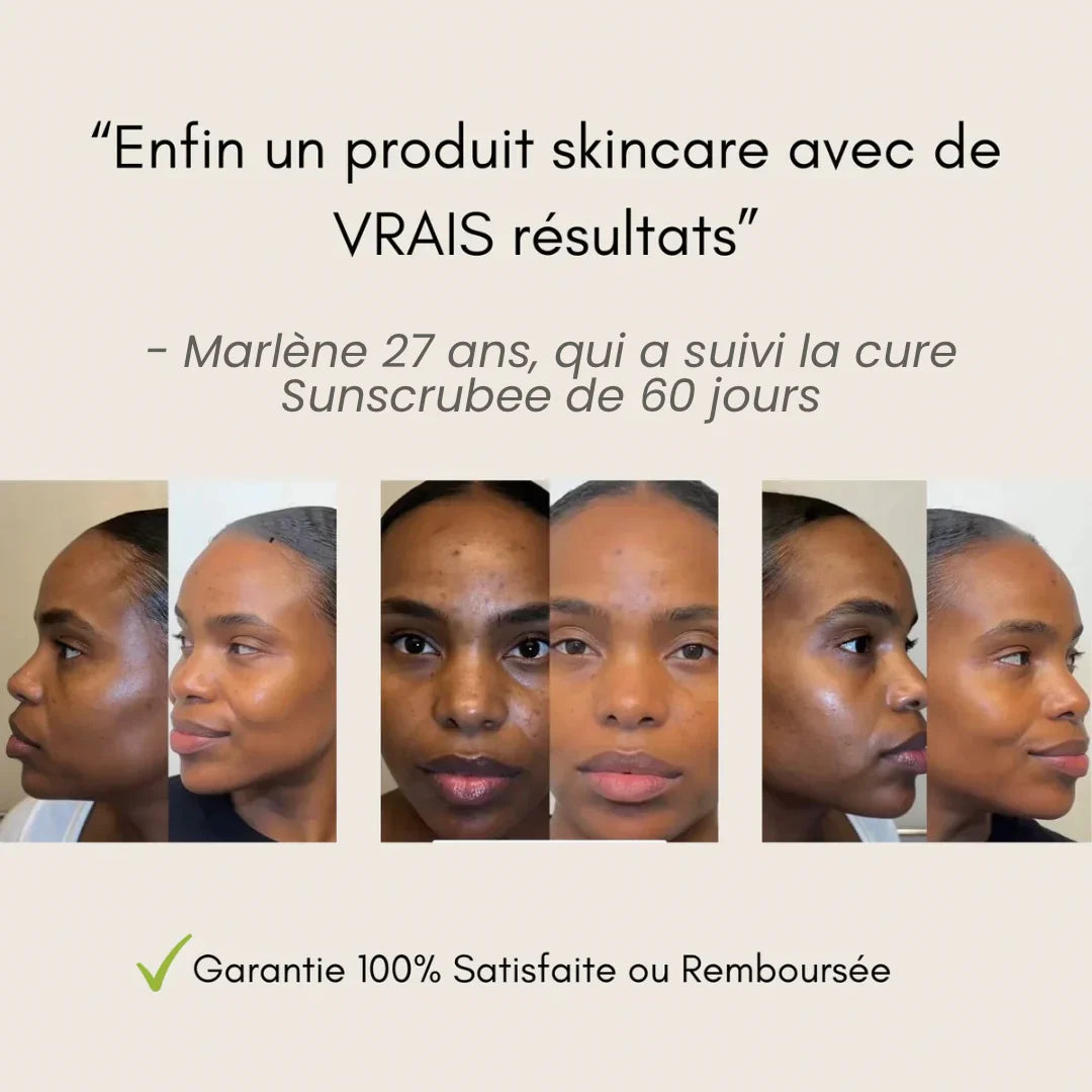 Pads Nettoyant Anti-Imperfections au Curcuma - 40 Cotons 🇧🇯
