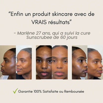 Pads Nettoyant Anti-Imperfections au Curcuma - 40 Cotons 🇧🇯