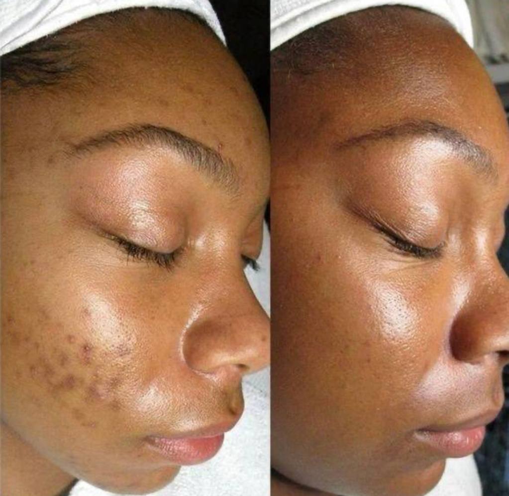 Duo Dr-Rashel Crème & Sérum Anti-tache & Ride