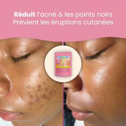 Pads Nettoyant Anti-Imperfections au Curcuma - 40 Cotons 🇧🇯