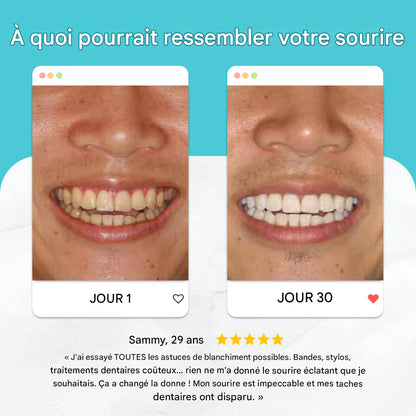Brosse à dents Sonique